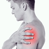 Артрит плечевого сустава